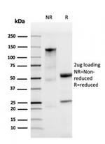 Ferritin, Light Chain Antibody in SDS-PAGE (SDS-PAGE)