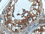 UBAC2 Antibody in Immunohistochemistry (Paraffin) (IHC (P))