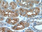 AQP7 Antibody in Immunohistochemistry (Paraffin) (IHC (P))