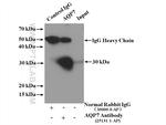 AQP7 Antibody in Immunoprecipitation (IP)