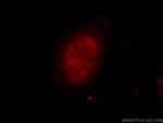 ZNF326 Antibody in Immunocytochemistry (ICC/IF)