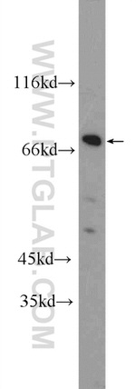 ZNF326 Antibody in Western Blot (WB)