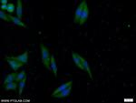 ATG2B Antibody in Immunocytochemistry (ICC/IF)