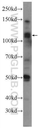 TDRD5 Antibody in Western Blot (WB)