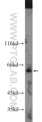 FAM20A Antibody in Western Blot (WB)