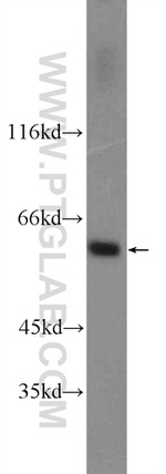 UAP1L1 Antibody in Western Blot (WB)