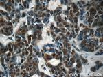 RBM25 Antibody in Immunohistochemistry (Paraffin) (IHC (P))