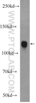 RBM25 Antibody in Western Blot (WB)