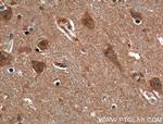 EHD3 Antibody in Immunohistochemistry (Paraffin) (IHC (P))