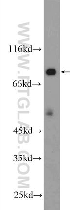 HECTD2 Antibody in Western Blot (WB)