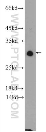 NUP62CL Antibody in Western Blot (WB)
