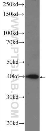 RRP36 Antibody in Western Blot (WB)