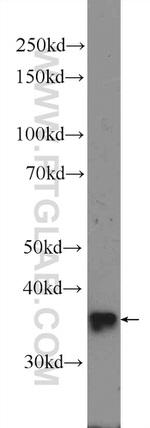 RRP36 Antibody in Western Blot (WB)