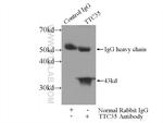 TTC35 Antibody in Immunoprecipitation (IP)