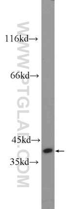 TTC35 Antibody in Western Blot (WB)