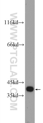 TTC35 Antibody in Western Blot (WB)