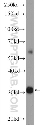 TTC35 Antibody in Western Blot (WB)