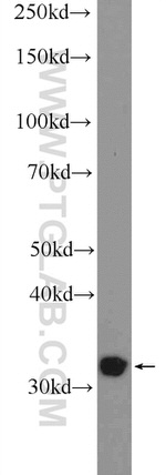 TTC35 Antibody in Western Blot (WB)