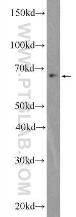 ZBTB46 Antibody in Western Blot (WB)