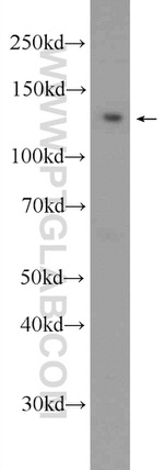 STK10 Antibody in Western Blot (WB)