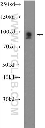 FSD2 Antibody in Western Blot (WB)