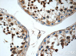 C19orf36 Antibody in Immunohistochemistry (Paraffin) (IHC (P))