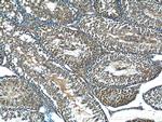 C19orf36 Antibody in Immunohistochemistry (Paraffin) (IHC (P))