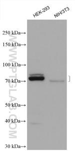 KIAA1279 Antibody in Western Blot (WB)