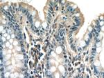 UACA Antibody in Immunohistochemistry (Paraffin) (IHC (P))