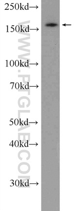 UACA Antibody in Western Blot (WB)