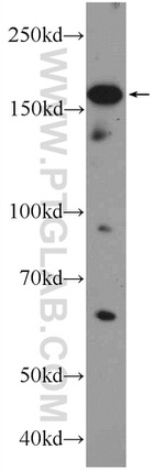 UACA Antibody in Western Blot (WB)