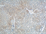 DENND1A Antibody in Immunohistochemistry (Paraffin) (IHC (P))