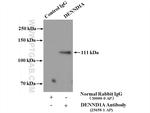 DENND1A Antibody in Immunoprecipitation (IP)