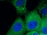 CD63 Antibody in Immunocytochemistry (ICC/IF)