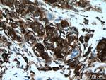 CD63 Antibody in Immunohistochemistry (Paraffin) (IHC (P))