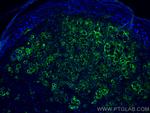 CD63 Antibody in Immunohistochemistry (PFA fixed) (IHC (PFA))