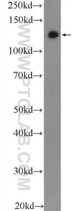 TACC3 Antibody in Western Blot (WB)