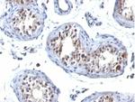 HGAL (Human Germinal Center Associated Lymphoma Marker) Antibody in Immunohistochemistry (Paraffin) (IHC (P))