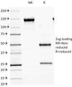 GAD2/GAD65 Antibody in SDS-PAGE (SDS-PAGE)