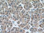 CARNS1 Antibody in Immunohistochemistry (Paraffin) (IHC (P))