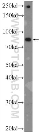 CARNS1 Antibody in Western Blot (WB)