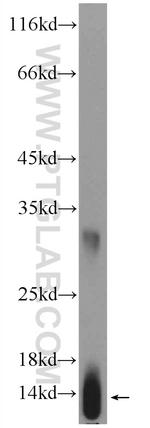 HBG1 Antibody in Western Blot (WB)