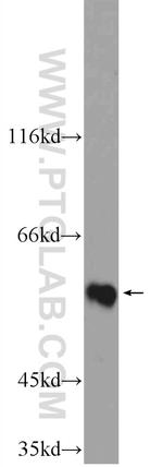 ZNF649 Antibody in Western Blot (WB)