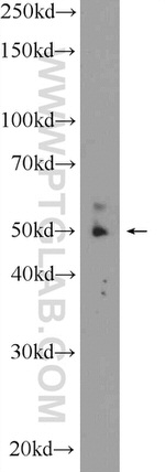 ZNF649 Antibody in Western Blot (WB)