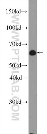 RNPC3 Antibody in Western Blot (WB)