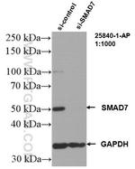 SMAD7 Antibody in Western Blot (WB)