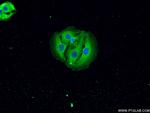 TH Antibody in Immunocytochemistry (ICC/IF)