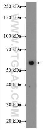 TH Antibody in Western Blot (WB)