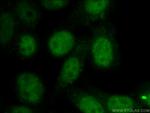 SNW1 Antibody in Immunocytochemistry (ICC/IF)
