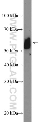 GALNT9 Antibody in Western Blot (WB)